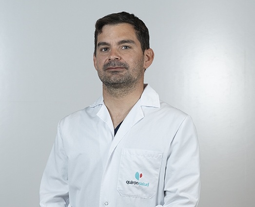La cirugía robótica reduce el impacto quirúrgico en pacientes con cáncer de ovario