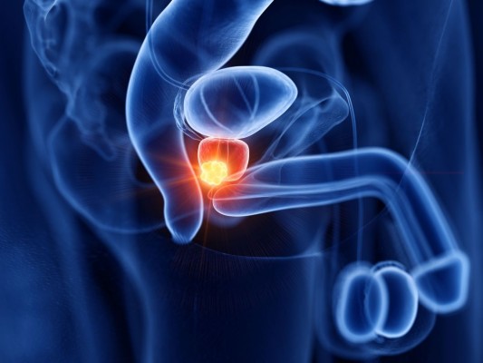 Nuevos datos de ASCO 2026 respaldan la eficacia de la terapia con radioligandos en cáncer de próstata metastásico sensible al tratamiento hormonal 
