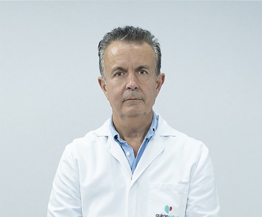 La cirugía laparoscópica, alternativa eficaz para poner fin al reflujo gastroesofágico y al uso crónico de antiácidos