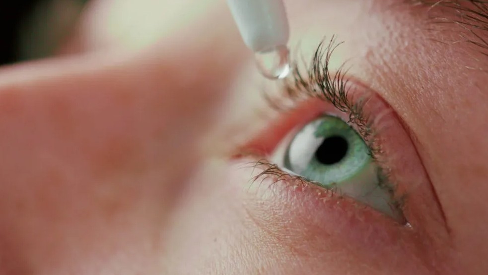 Vissum Grupo Miranza impulsa la medicina regenerativa ocular con plasma rico en plaquetas para el ojo seco