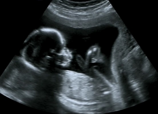 Los fetos intentan vocalizar cuando escuchan música por vía vaginal