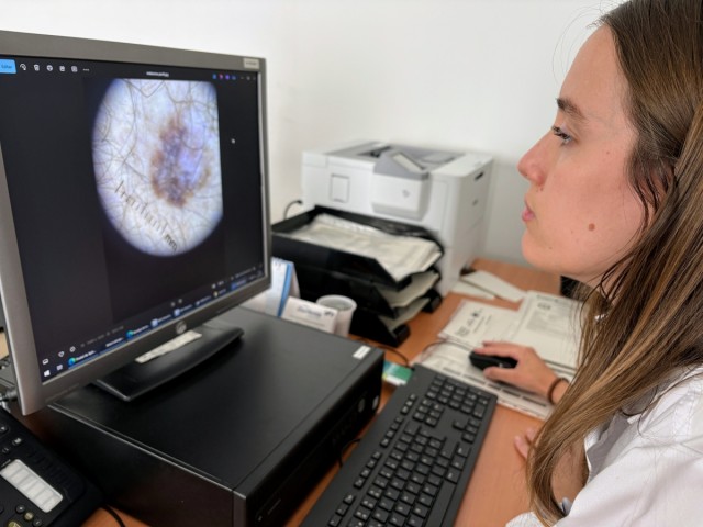 El Departamento de Salud de Orihuela refuerza la teledermatología tras atender 2.400 consultas