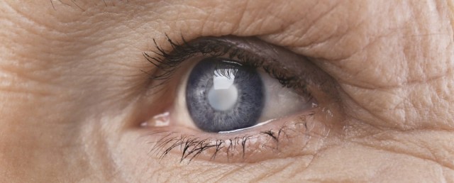 Ventajas de la operación de cataratas con lente intraocular