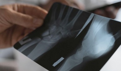 Traumatología en Valencia: especialización y cirugía avanzada en Quirónsalud