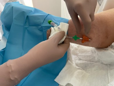 El General de Elche impulsa un equipo especializado para mejor acceso vascular de hospitalizados y ambulatorios