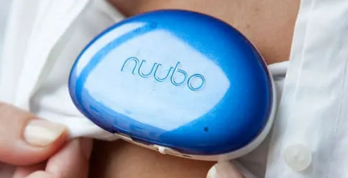 - Foto: NUUBO.