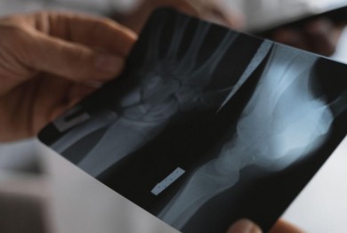 Traumatología en Hospital Quirónsalud Torrevieja: atención especializada para lesiones deportivas y patologías articulares