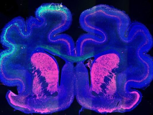 Investigadores descubren el posible mecanismo base del plegamiento de la corteza cerebral