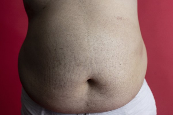 
‘Lorzas’: un grito fotográfico contra la gordofobia