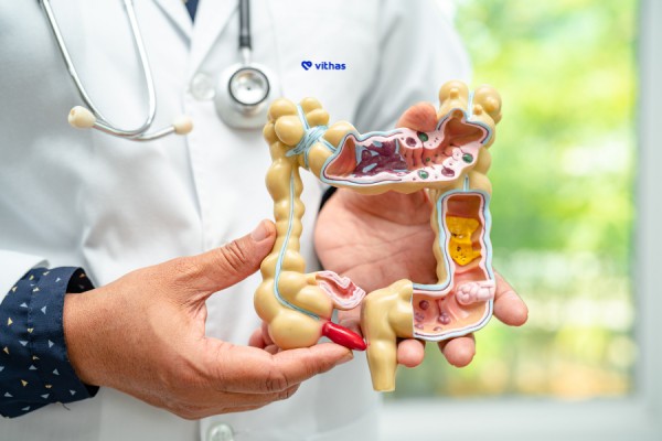 Especialistas de Vithas CV advierten de que el estrés influye en una deficiente salud digestiva