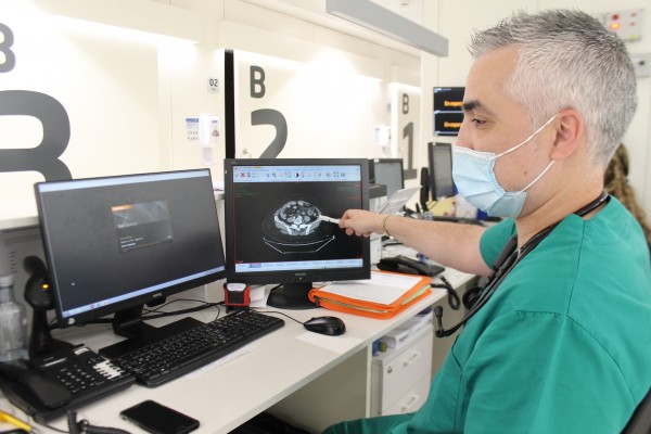 La extirpación del apéndice podría reducir el riesgo de padecer cáncer colorrectal