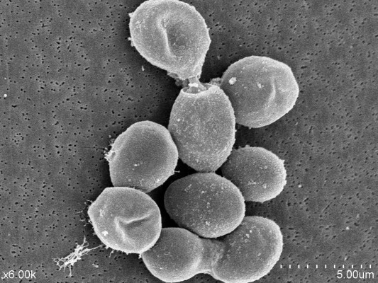 Investigadores del CSIC patentan un método para producir serotonina a partir de levadura del vino