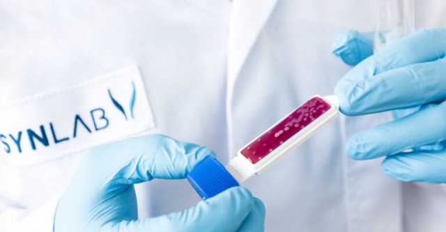 La valenciana Sistemas Genómicos redujo un 19% su facturación en 2022 tras la compra de la alemana Synlab