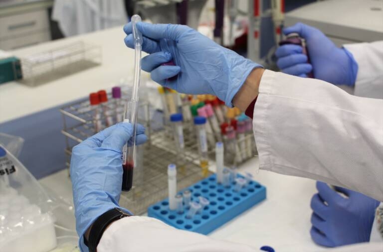 Foto: FUNDACIÓN DE INVESTIGACIÓN DEL GENERAL DE VALENCIA - 