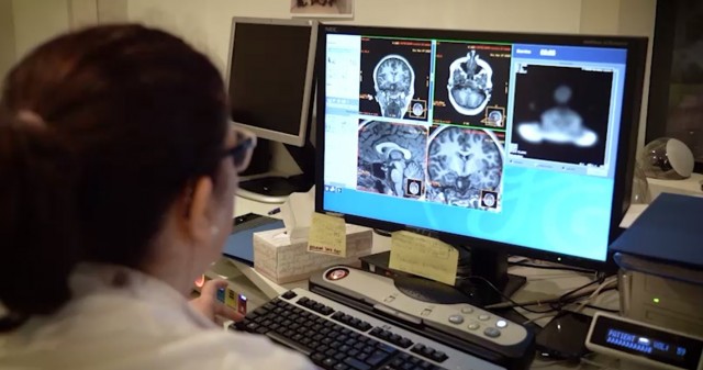 Detectan con un análisis de sangre un mecanismo clave en el desarrollo del Alzheimer en humanos
