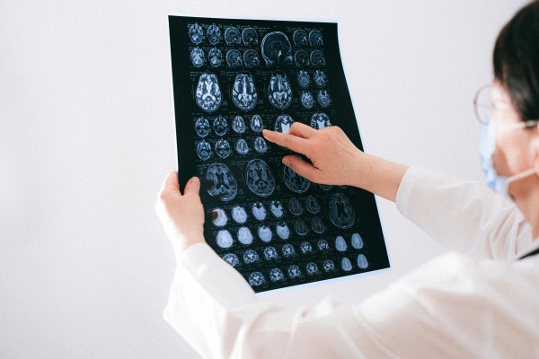 Un estudio demuestra que los cerebros humanos son cada vez más grandes