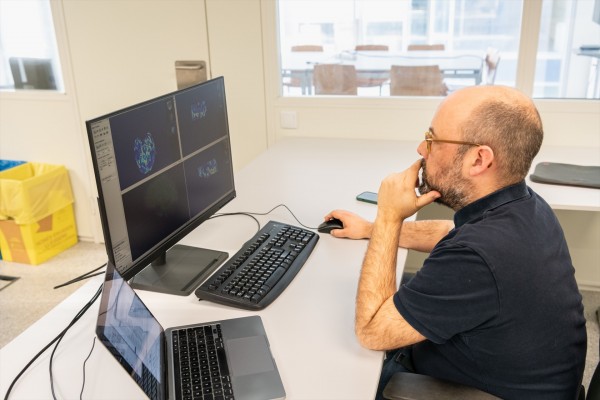 Hallan una nueva vía para la eficacia del tratamiento de tumores cerebrales
