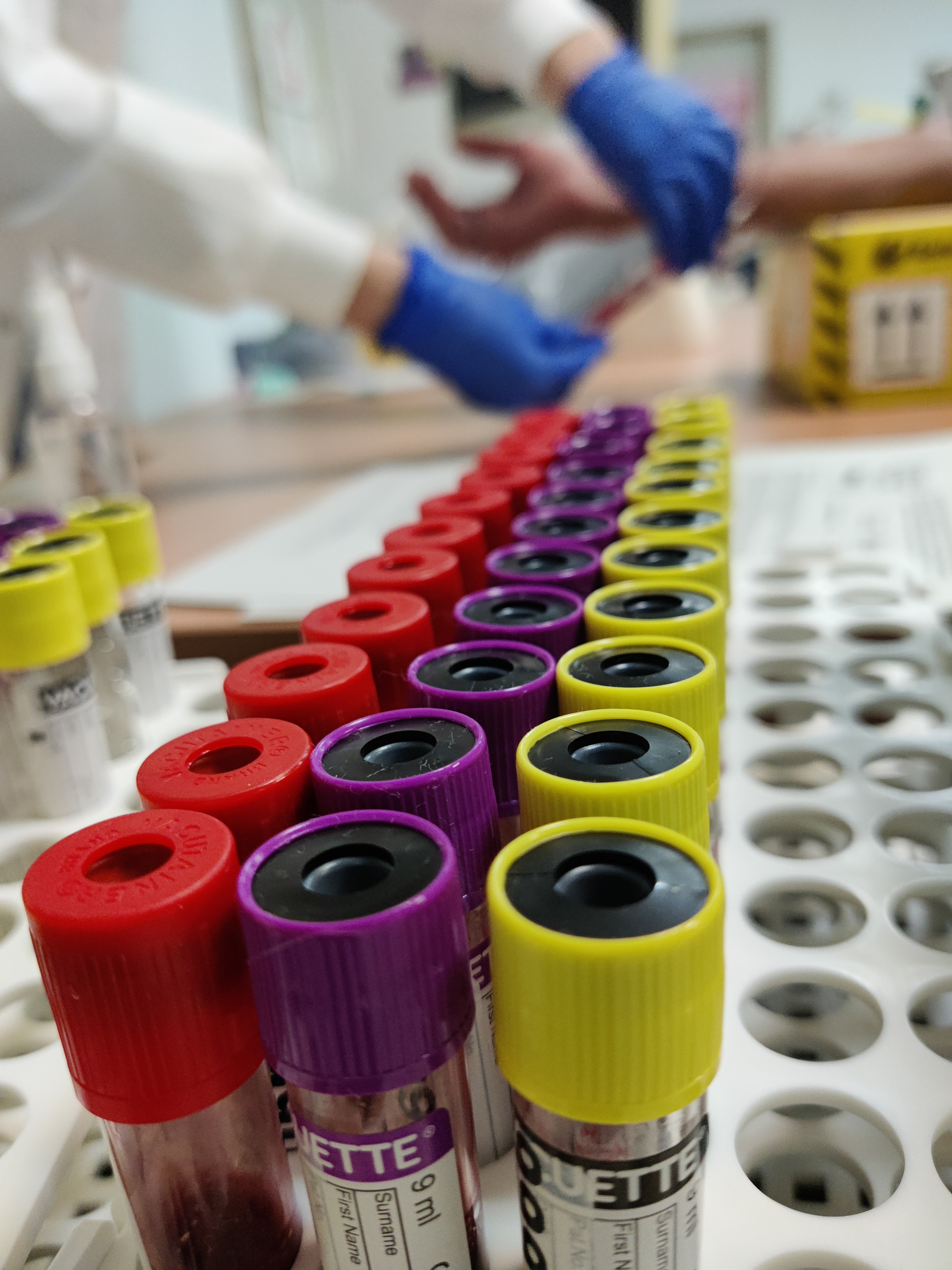 Fisabio rep una donació per a una investigació de la malaltia d'Alzheimer en la qual participa l'UJI

