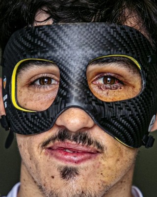 Diego López estrena máscara para proteger su pómulo, pero sigue en el gimnasio