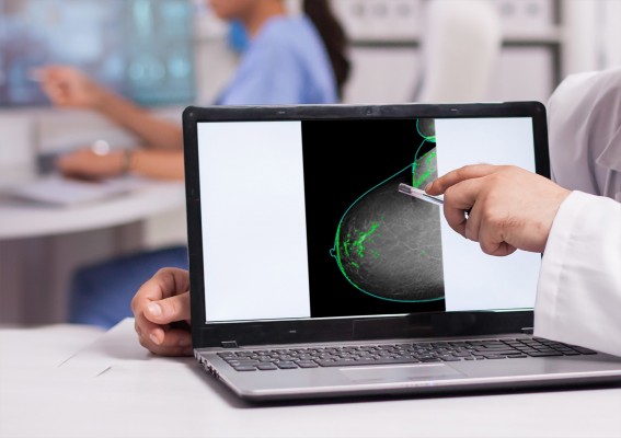 ITI impulsa un software basado en IA para alertar sobre el potencial desarrollo de cáncer de mama