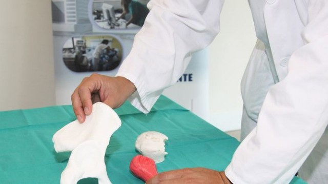 El Hospital La Fe introduce la impresión 3D en la planificación de intervenciones de tumores óseos