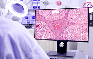 Desarrollan algoritmos de IA para el diagnóstico y tratamiento de tumores cancerosos