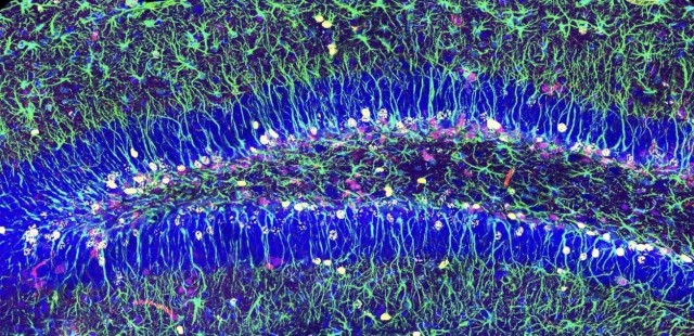 Hallan un mecanismo que asegura la reserva de células madre para generar neuronas en adultos
