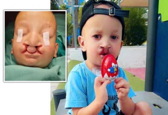 Una acción de Vithas y el Dr. Solís permite que un niño pueda empezar a comer por sí mismo
