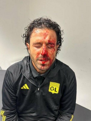 El Lyon lamenta que la Liga francesa no asuma 