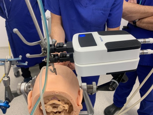 La UMH crea una técnica pionera para implantar microelectrodos con un robot en el cerebro de personas ciegas