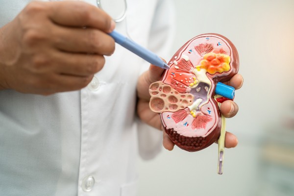 Nefrectomía parcial: características y beneficios