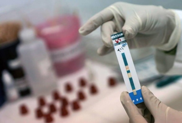 Asociaciones advierten de que el 43% de los diagnósticos de VIH son tardíos y piden prevenir
