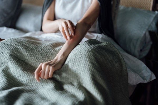 Las personas con urticaria crónica tardan más de tres años hasta conseguir un diagnóstico
