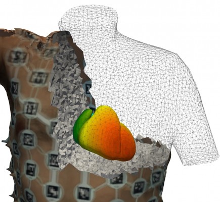 Investigadores de la UPV crean una herramienta para generar gemelos digitales cardíacos