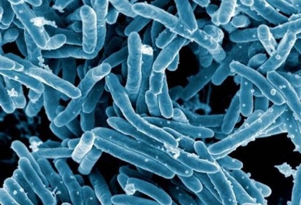 La OMS resalta que la tuberculosis se ha reducido un 52% en dos décadas en Europa