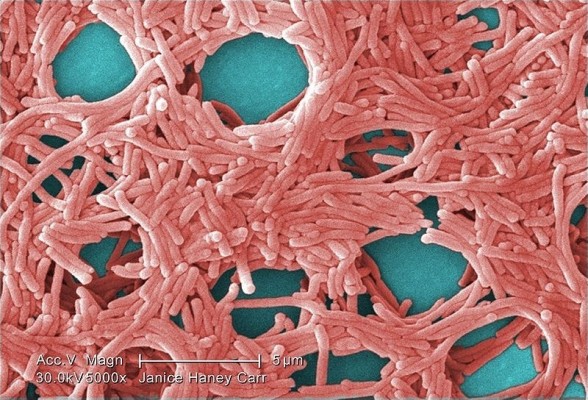 Salud Pública detecta un brote de legionella en Alberic con 15 casos, de evolución favorable