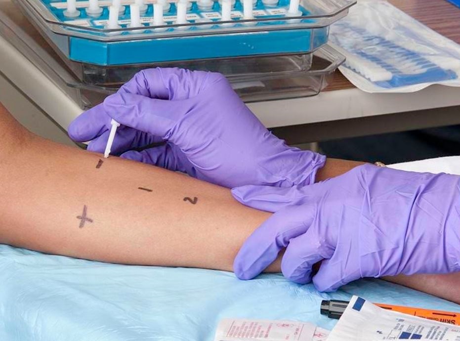 Investigadores descubren una herramienta innovadora para diagnosticar alergias alimentarias
