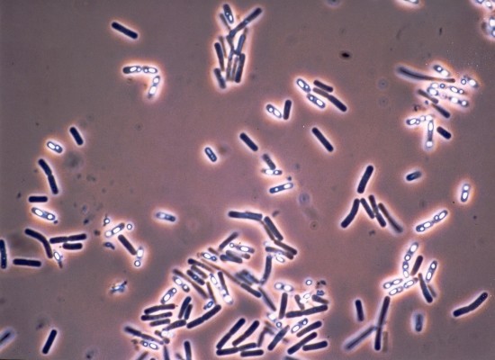 Un nuevo biosensor detecta bacterias en los alimentos más rápido y barato

