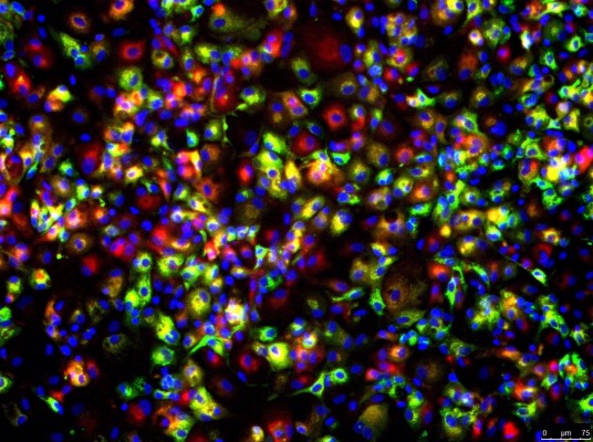 IIS La Fe desarrolla una estrategia singular que permite generar hepatocitos a partir de los fibroblastos de un paciente