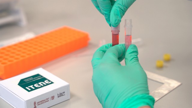 Celulosa con piel de naranja y kits rápidos para detectar E-Coli, en el TechShow de Itene