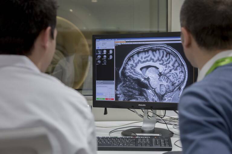 Las anomalías en el neurodesarrollo podrían sentar las bases de la enfermedad de Alzheimer