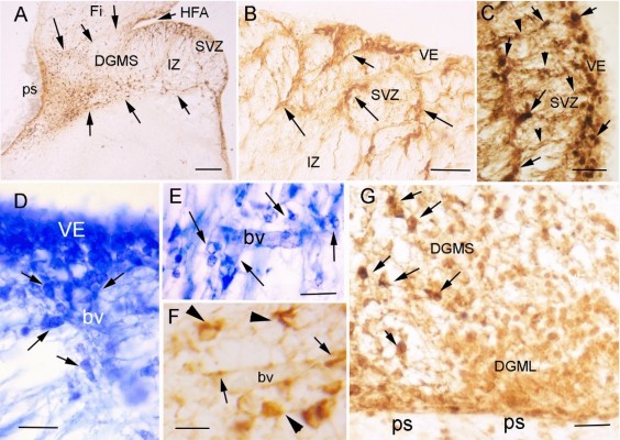 La transmisión de la covid-19 al feto afectaría al desarrollo del cerebro y a la memoria