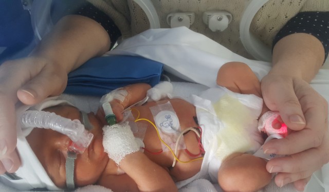 Ayudas desconocidas para padres de niños prematuros o con patologías