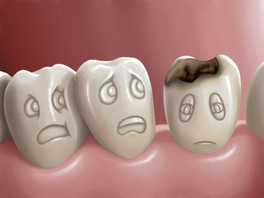 El consumo de alcohol y tabaco es un factor de riesgo que acelera los procesos de caries