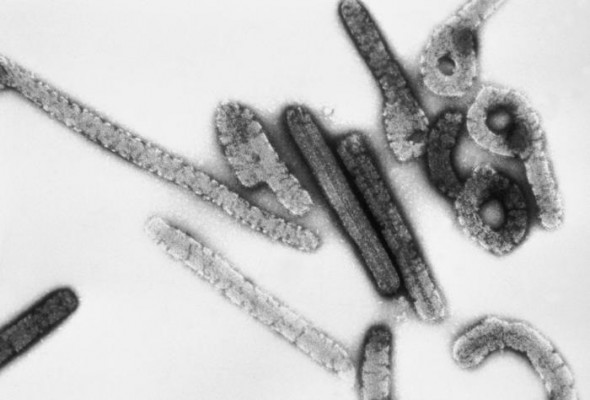 El Ministerio de Sanidad elabora un protocolo para la detección y manejo de casos de Marburgo
