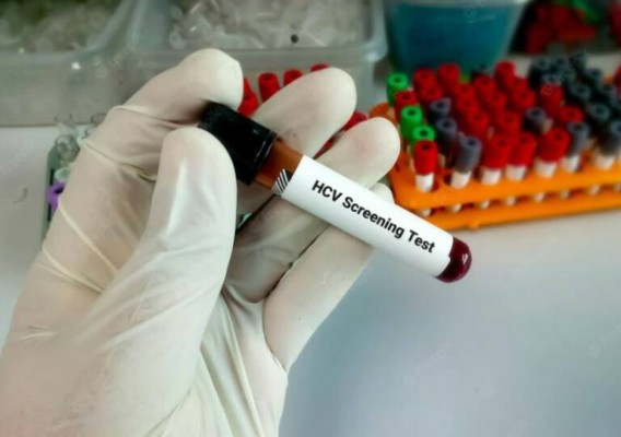 Murcia contará con 'checkpoint' para realizar pruebas de VIH en la calle este jueves