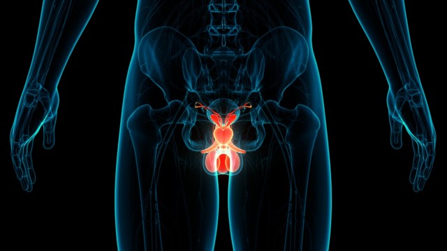 Desarrollan un análisis de sangre que detecta con un 94% de precisión el cáncer de próstata
