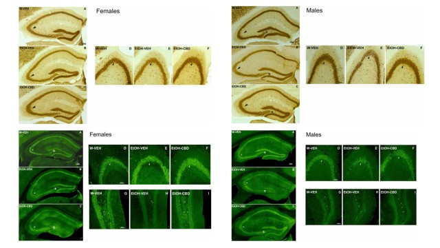 El cannabidiol repara el daño cerebral y las alteraciones con espectro alcohólico fetal