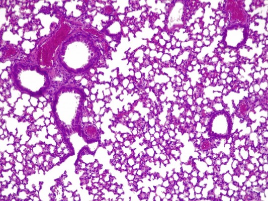 Crean una 'píldora viva' para combatir infecciones pulmonares resistentes a antibióticos
