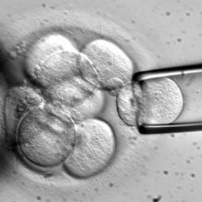 Un estudio muestra que las células utilizan principios mecánicos para integrarse en los tejidos
